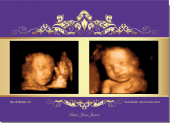 Baby Scan Keepsake Card with 2 photo upload and scan details